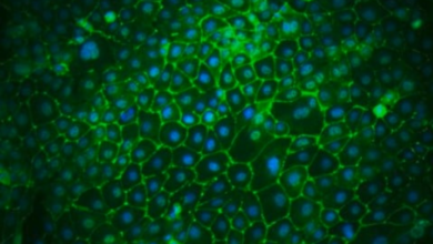 The Significance of A704 Cells in Endocrine Research