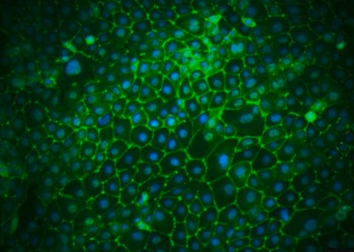 The Significance of A704 Cells in Endocrine Research