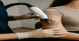 Tattoo removal:How many sessions do you really need for a clean result?
