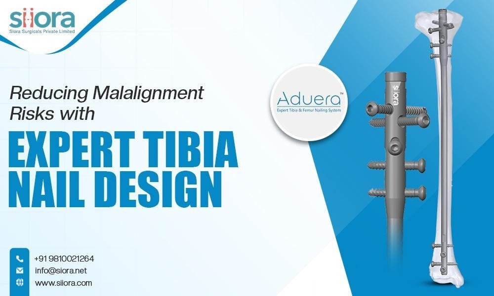 Reducing Malalignment Risks with Expert Tibia Nail Design