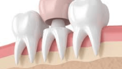 Crown Lengthening: When Periodontists Reshape Gum And Bone For Restorations