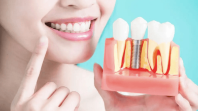2 Indicators You’re Ready To Transition From Dentures To Implants