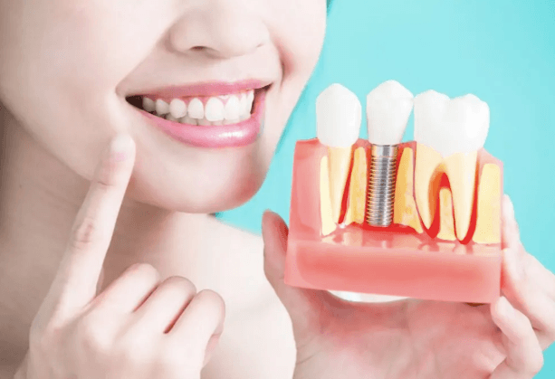 2 Indicators You’re Ready To Transition From Dentures To Implants