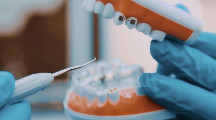 4 Benefits Of Combining Cosmetic And Restorative Services
