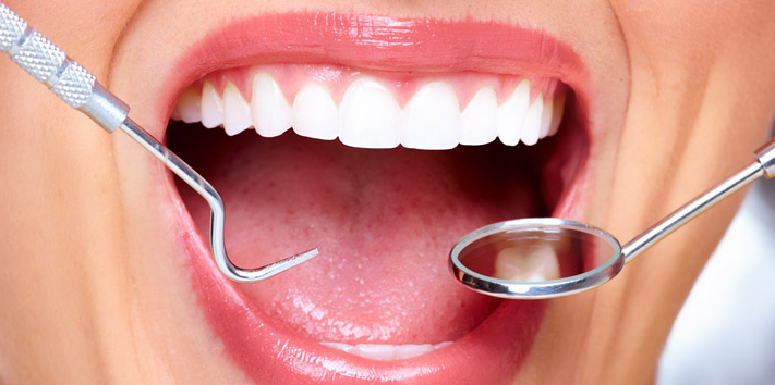 5 Ways Cosmetic Dentistry Can Be Conservative And Tooth Sparing