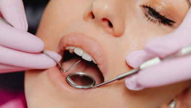 How General Dentistry Maintains Function Beneath Cosmetic Restorations