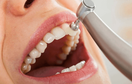 Why Regular Dental Cleanings Are Essential For Oral And Overall Health