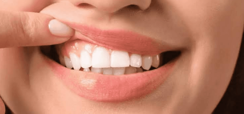 6 Tips For Caring For Your Gums And Implants Long Term