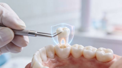 What “Temporary” Dental Repairs Really Mean (And How Long They Last)