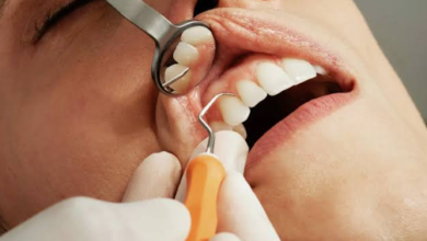 How Preventive Dentistry Supports Smile Design And Reconstruction