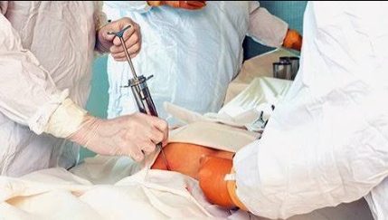 Autologous Stem Cell Transplantation: Established Uses and Common MisunderstandingsOverview